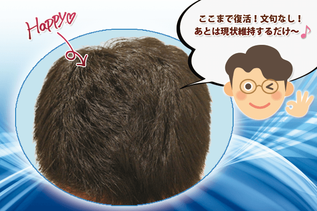 薄毛食堂 | チャップアップ(CHAPUP)+αで発毛実感中!