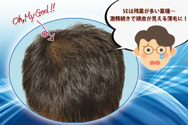 薄毛食堂 | チャップアップ(CHAPUP)+αで発毛実感中!