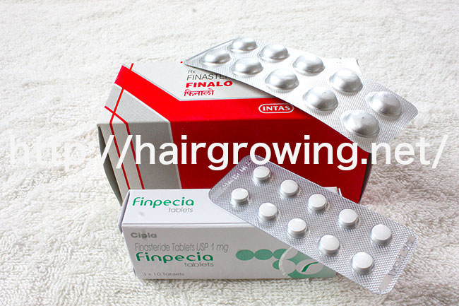 薄毛食堂 | チャップアップ(CHAPUP)+αで発毛実感中!